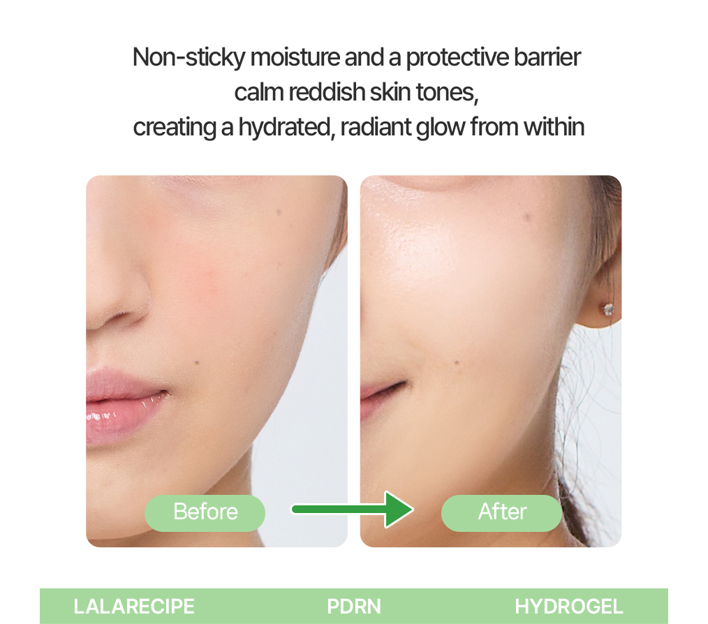 PDRN Melting Gel Mask Set of 4